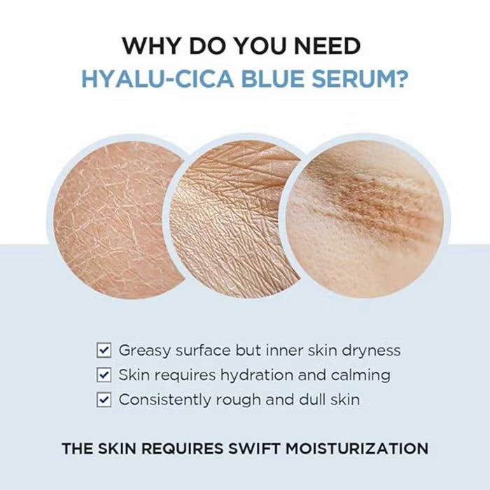 Skin1004 Madagascar Centella Hyalu Cica Blue Serum 30ml
