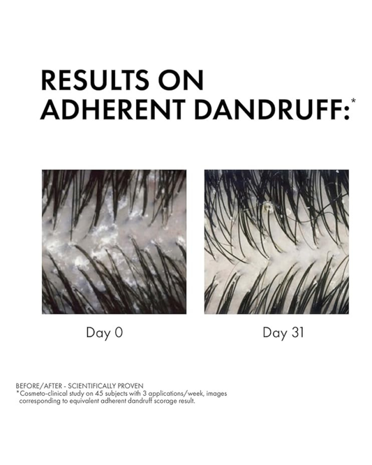 VICHY Dercos Anti Dandruff Shampoo for Dry Hair 200ml