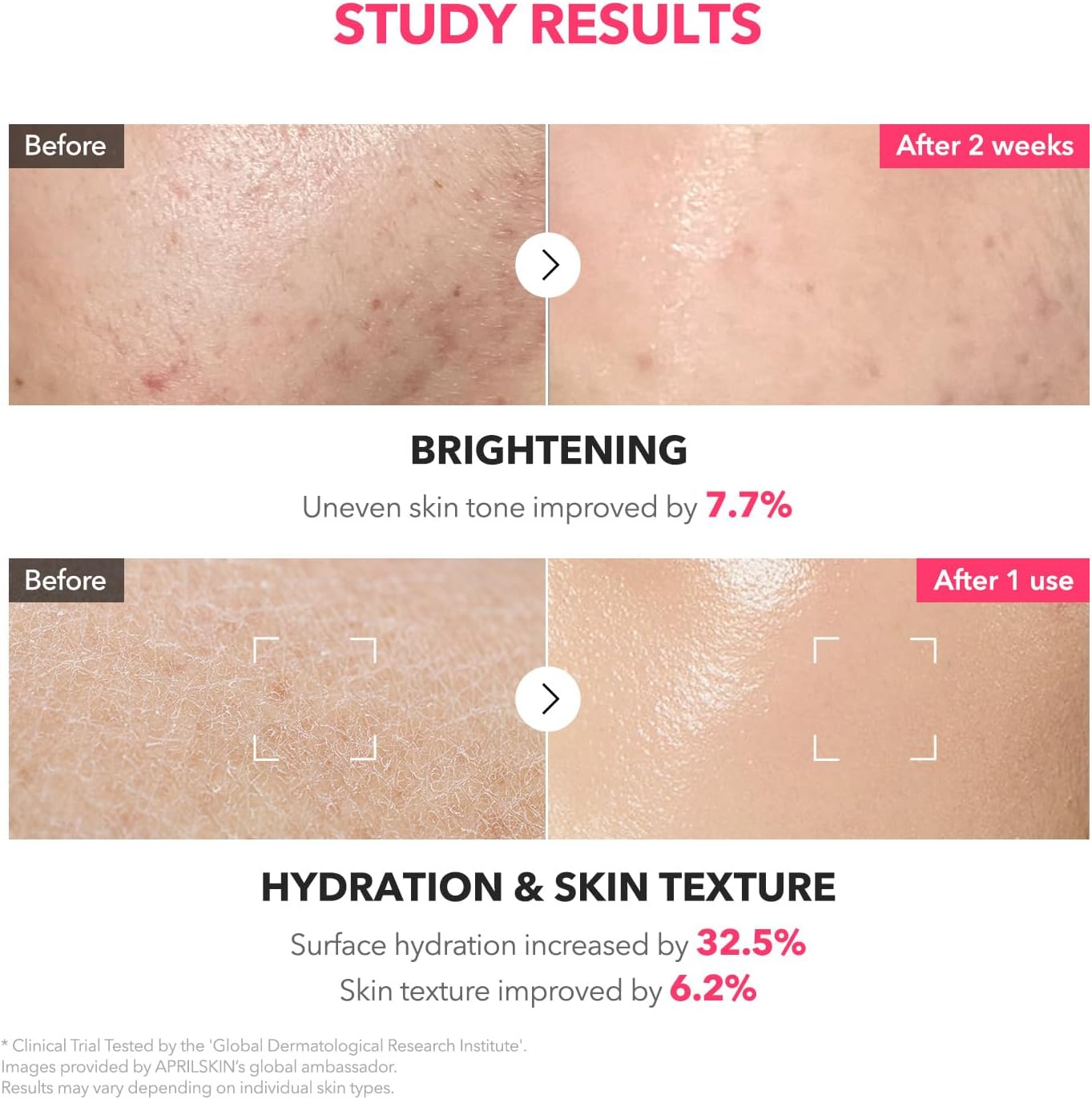 APRILSKIN TXA+Niacinamide 99 Pink Milky Toner 150ml