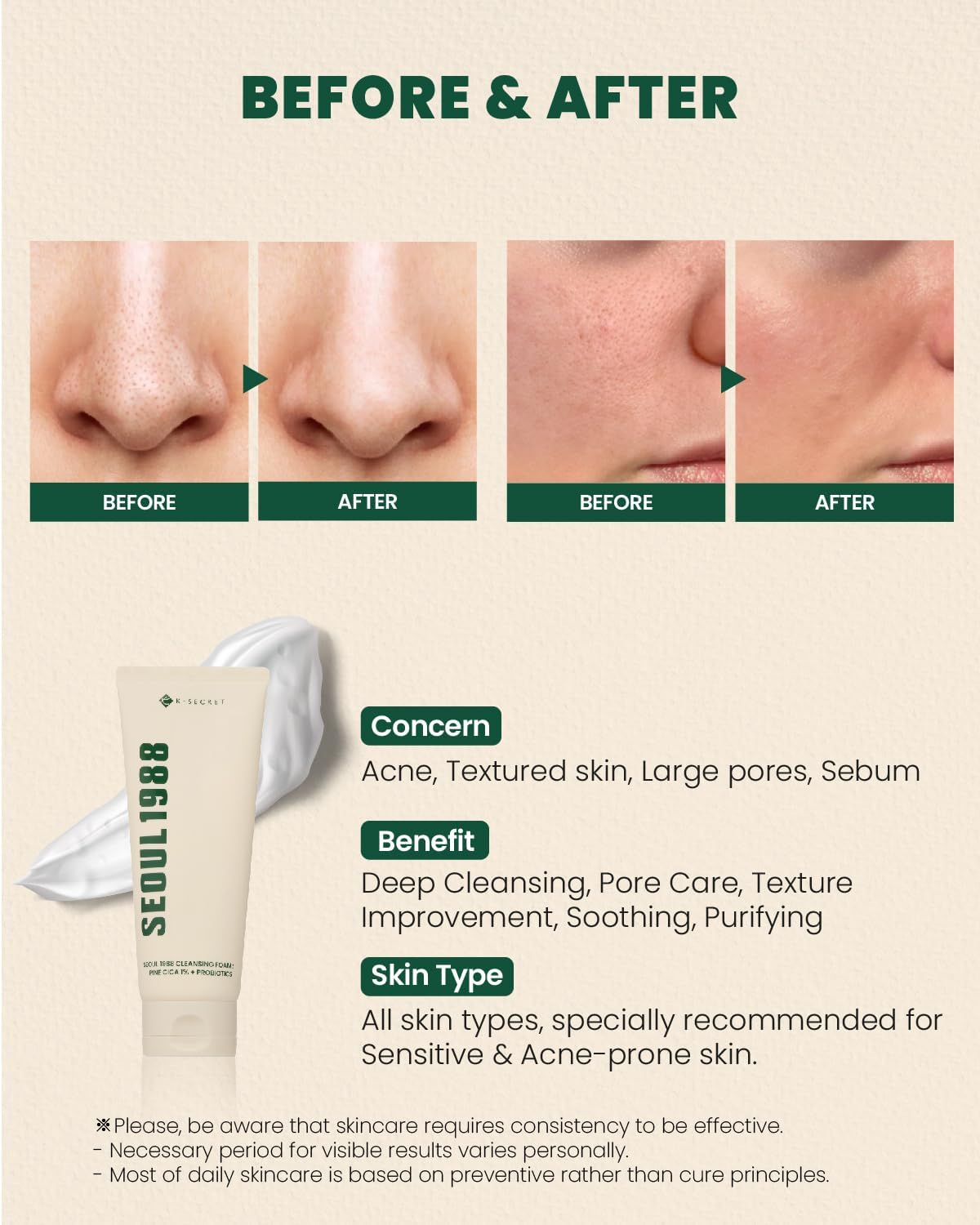K-SECRET Seoul 1988 : Cleansing Foam Pine Cica 1%, Probiotics 150ml