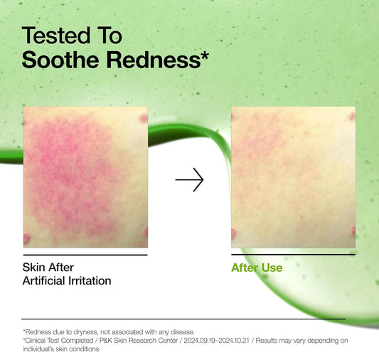 ANUA Azelaic Acid 10 + Hyaluron Serum 30ml