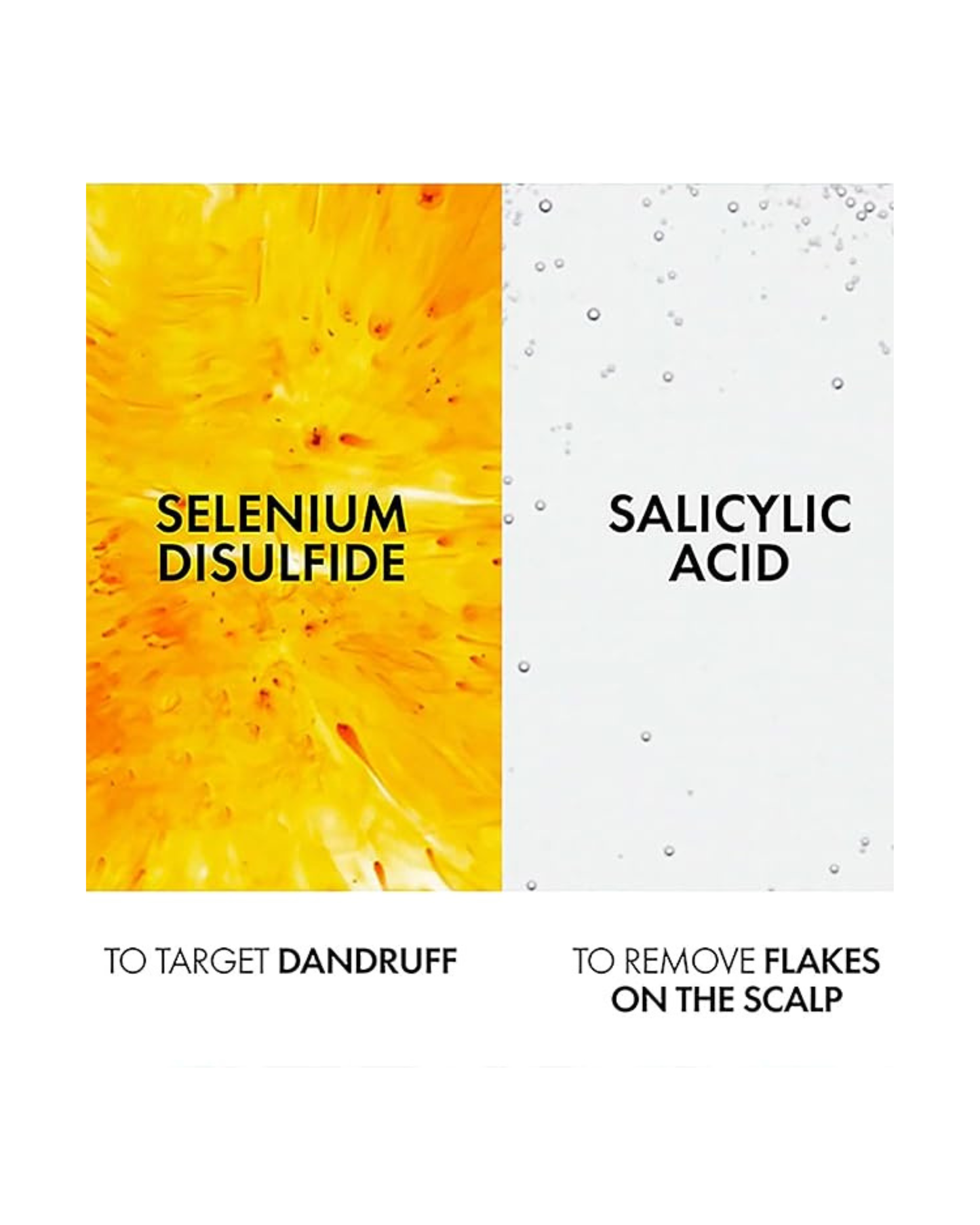 VICHY Dercos Anti Dandruff Shampoo for Dry Hair 200ml