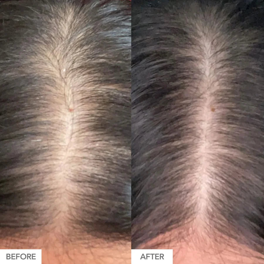 HAIRtamin Advanced Formula (30 Capsules)