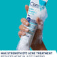 CeraVe Acne Foaming Cream Wash 10% Benzoyl Peroxide 150ml