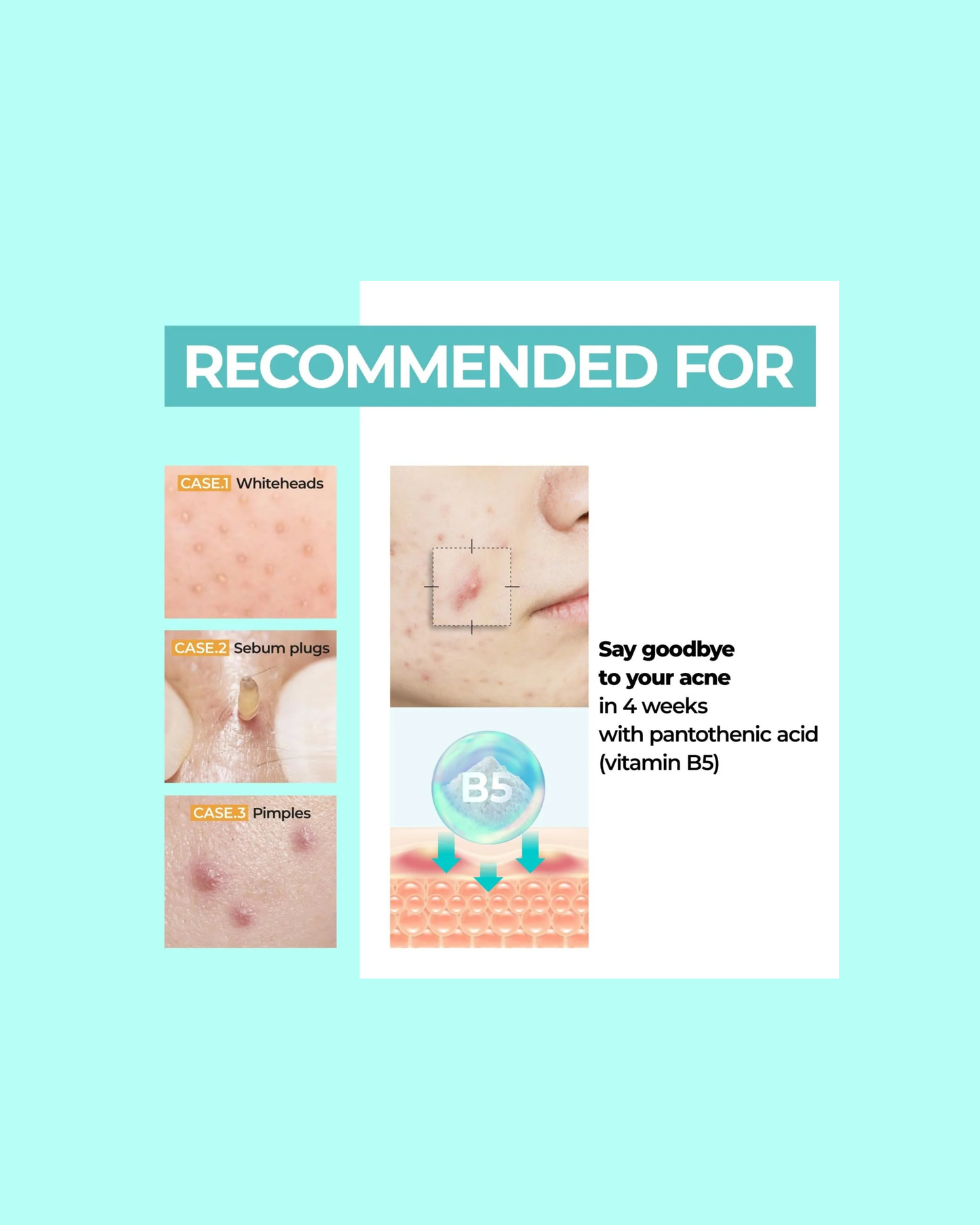 NUMBUZIN No.1 Pantothenic B5 Active Soothing Serum 50ml