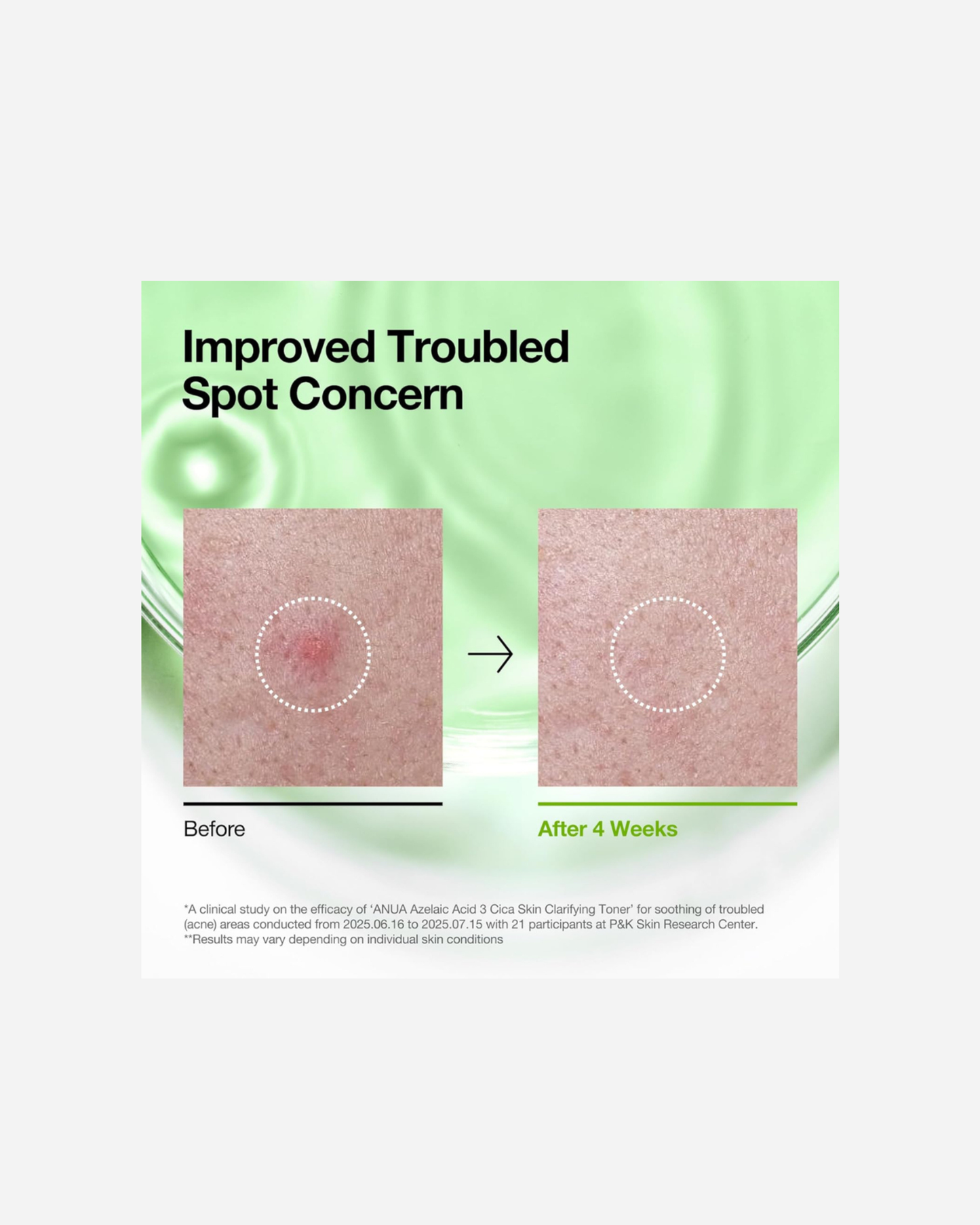 ANUA Azelaic Acid 3 Cica Skin Clarifying Toner 250ml