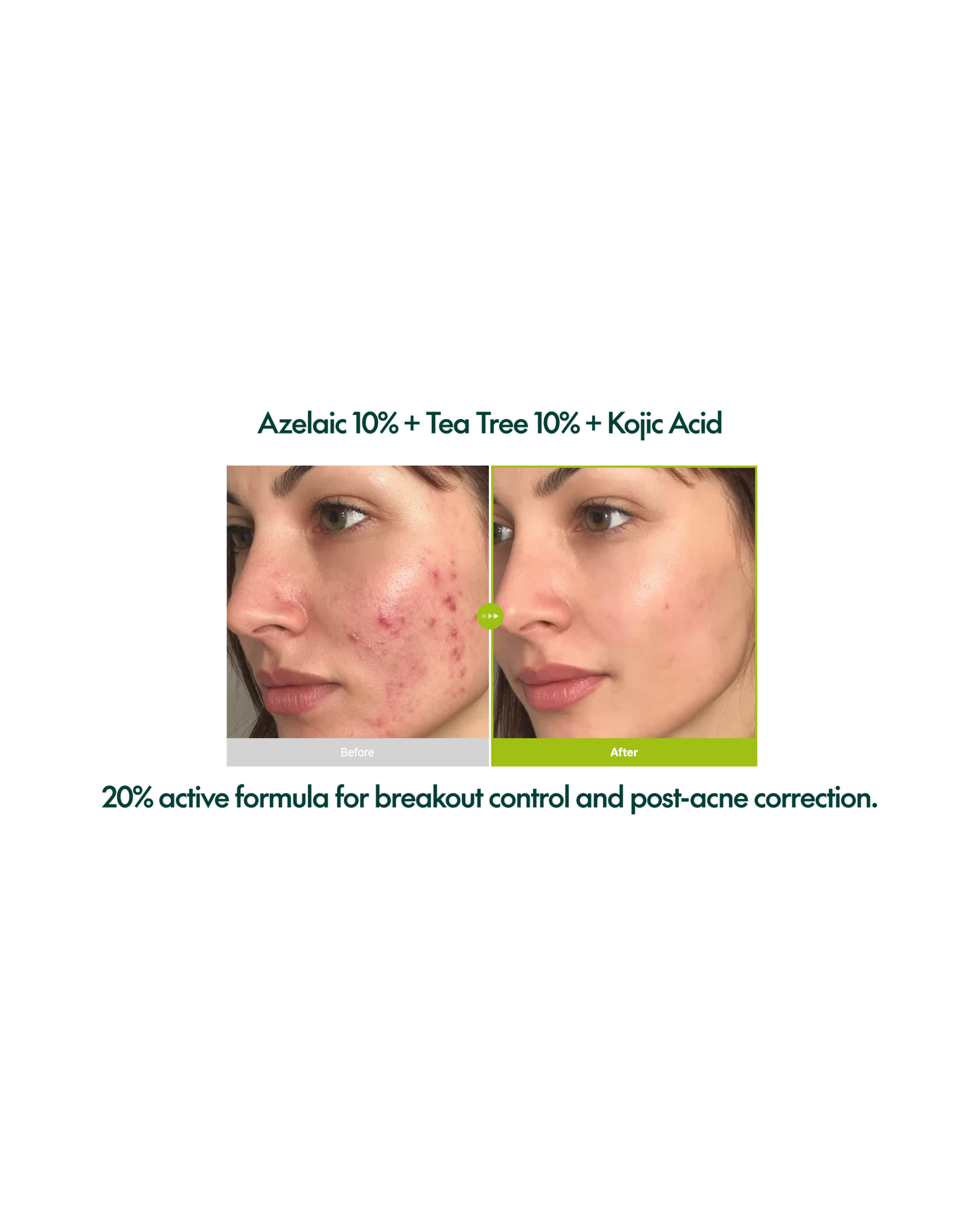 PURITO Azelaic Acid 10 Kojic Tea Tree Serum 30ml