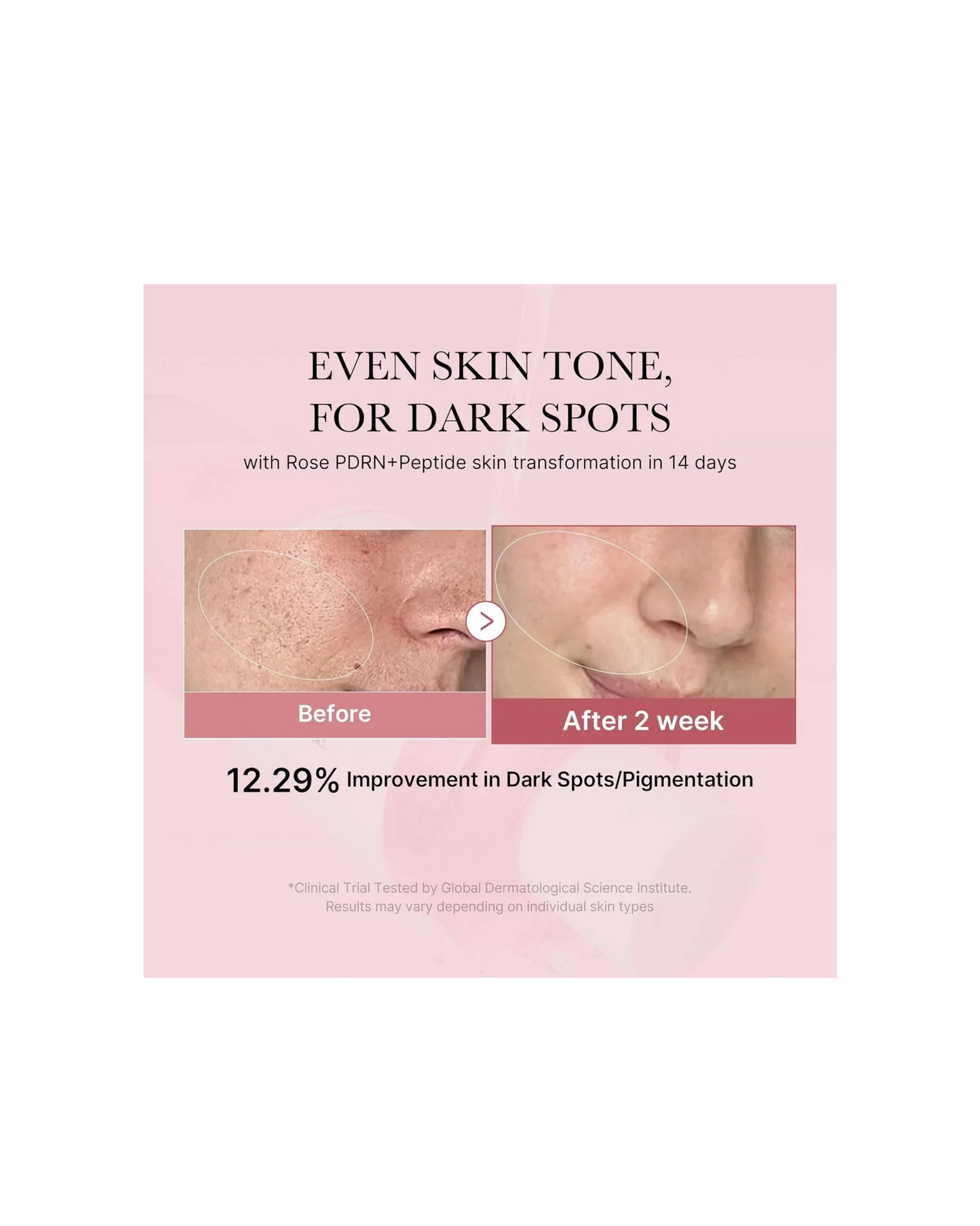 MEDICUBE PDRN Pink Niacinamide Milky Toner 150ml