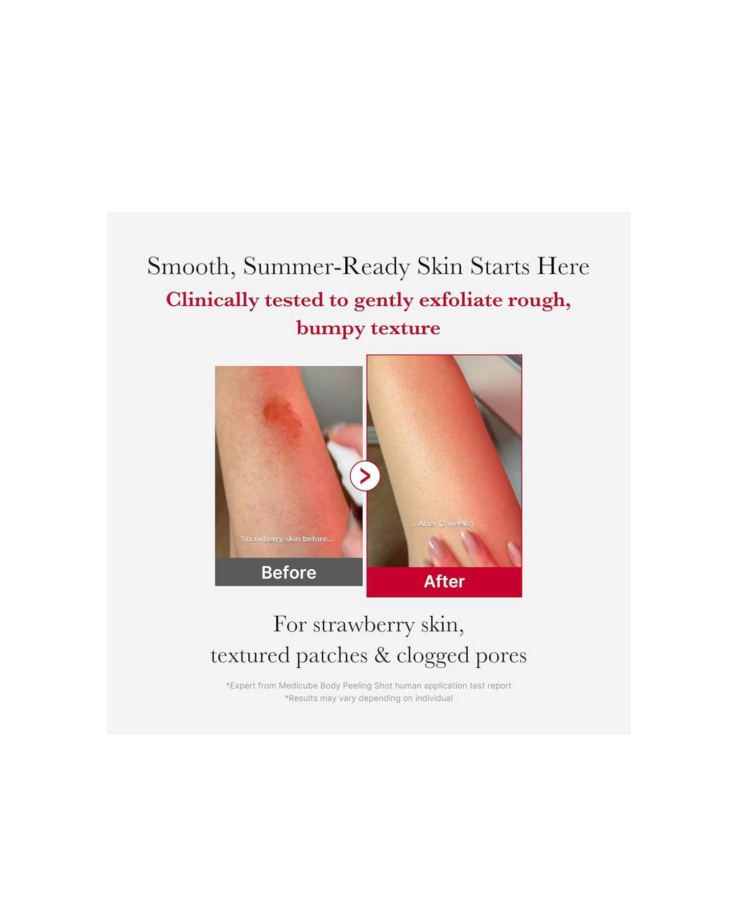 MEDICUBE Red Acne Body Peeling Shot 110g