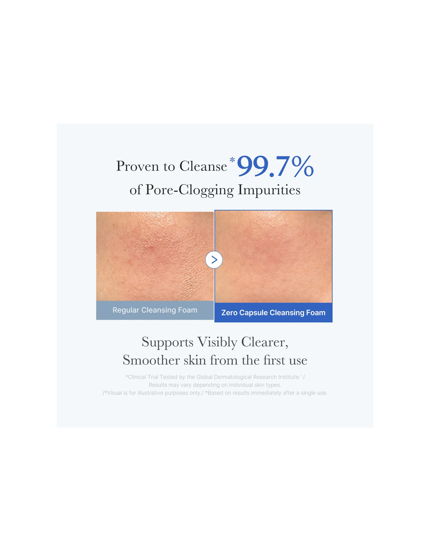 MEDICUBE Zero Pore SA Clear Capsule Cleansing Foam 120g