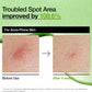 Anua Azelaic Acid 10% + Hyaluron Serum 30ml