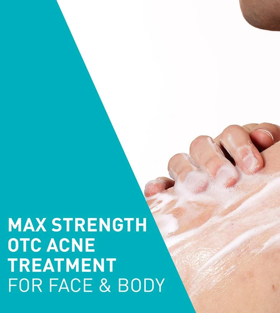 CeraVe Acne Foaming Cream Wash 10% Benzoyl Peroxide 150ml