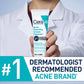 CeraVe Acne Foaming Cream Cleanser 4% Benzoyl Peroxide 150ml