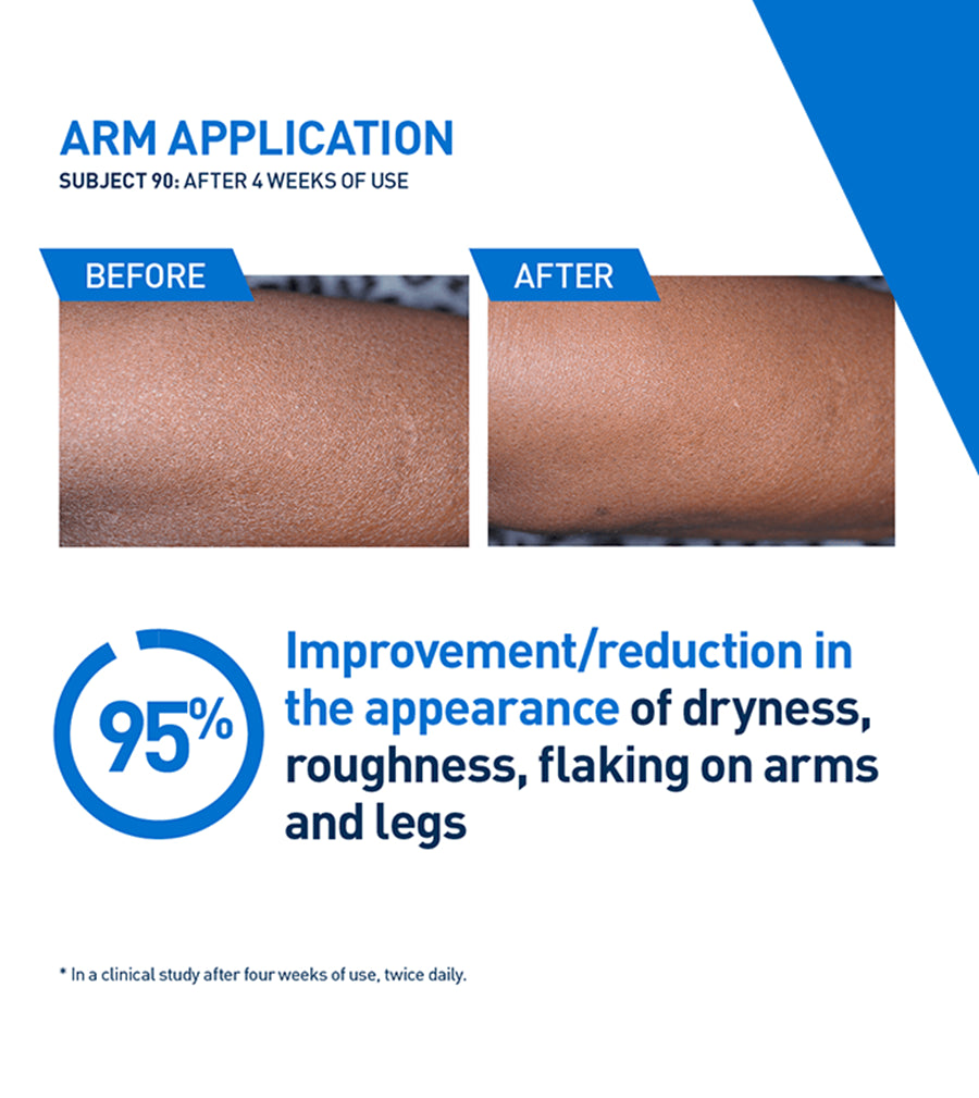 CeraVe Intensive Moisturizing Lotion